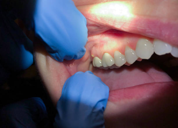 Best 24-Hour Emergency Dentist  in Mccullom Lake, IL