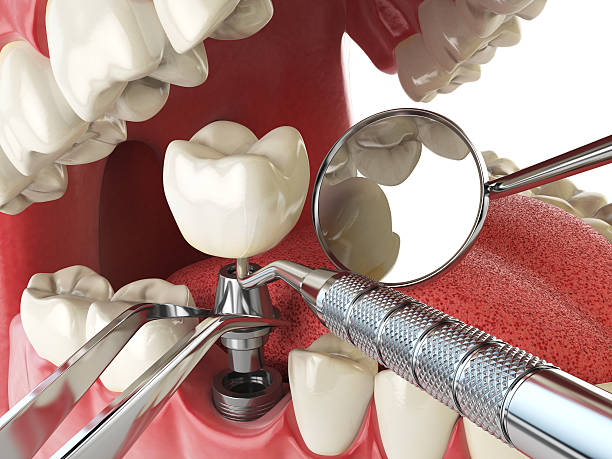 Best Emergency Dentist Open Today  in Mccullom Lake, IL